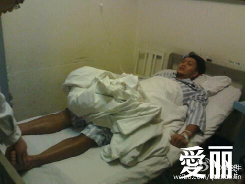 演员重伤可能瘫痪